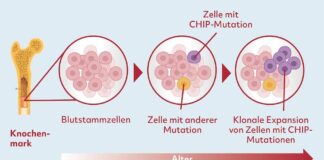CHIP-Mutationen: Neuer Risikofaktor für Herzpatienten enttarnt