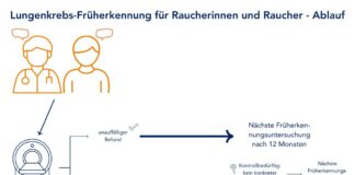 Lungenkrebsfrüherkennung ab 2026 auch für Kassenpatienten