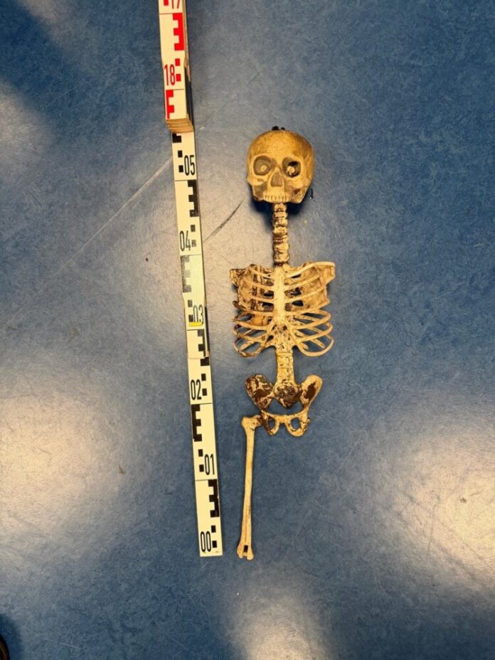 Das Plastik-Skelett mit Maßstab.